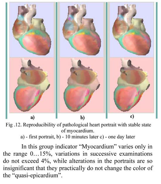 HeartVue heart portrait Doctor´s manual